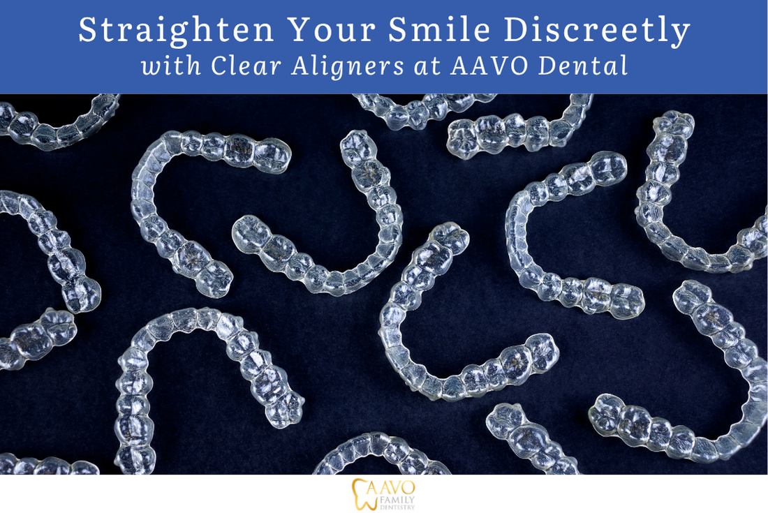 Straighten Your Smile Discreetly with Clear Aligners at AAVO Family Dentistry